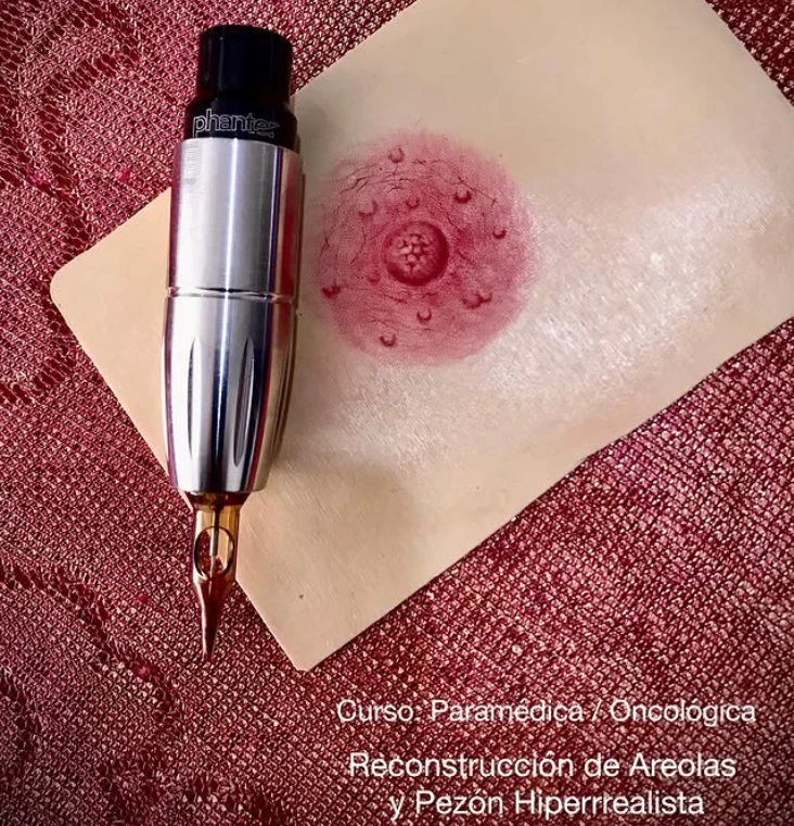 Reconstrucción de Areolas paramédica